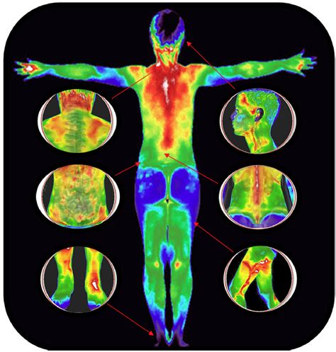 Full Body Scan - Thermal Imaging Texas - Angel Marlow - Houston, TX - Thermography - Thermal ...