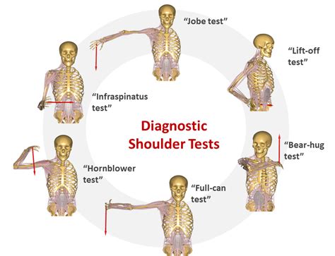 Shoulder Rotator Cuff Tests – NBKomputer