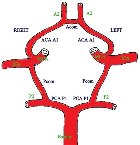 Neuroradiology Cases: Circle of Willis Anatomy