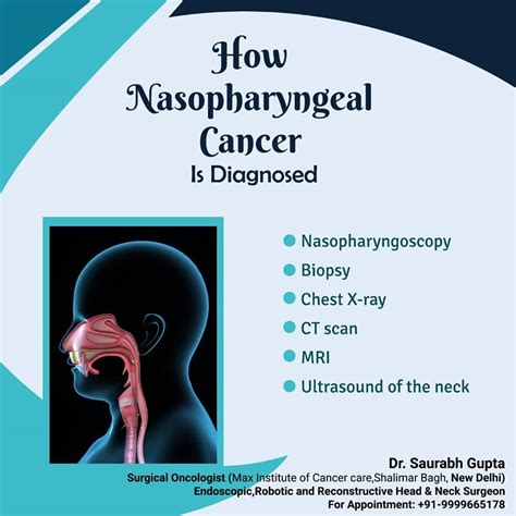 Nasopharyngeal Cancer Symptoms Stages Treatment