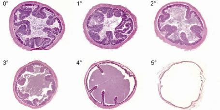 Caecum. The degree of mucosa damage. 0o – absence of morphological ...