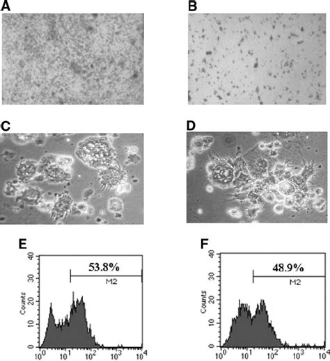 Microscopic examination of BM-DCs from NOD mice. BM cells from... | Download Scientific Diagram