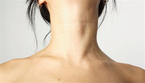 Thyroid-neck-rash-treatment - Trending 582cqw