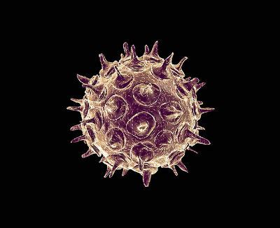 Varicella-zoster virus - microbewiki