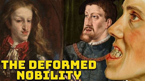 The Habsburg Jaw: The Royal Deformity Caused By Centuries, 50% OFF