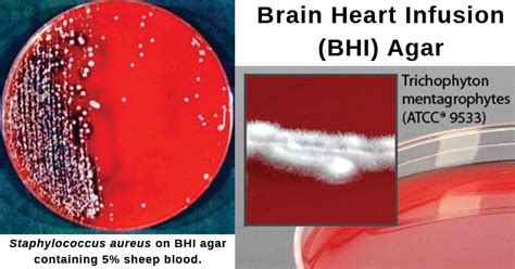 Brain Heart Infusion (BHI) Agar- Composition, Principle, Preparation ...