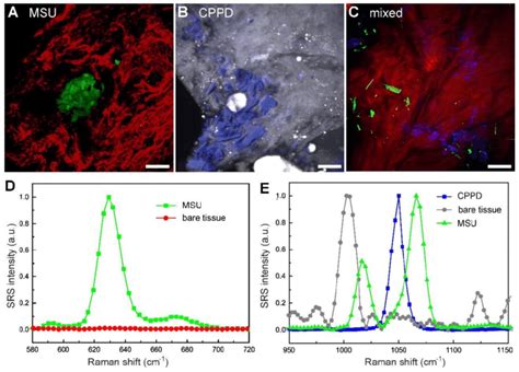 Differentiation of pseudogout and early detection of microcrystals in... | Download Scientific ...