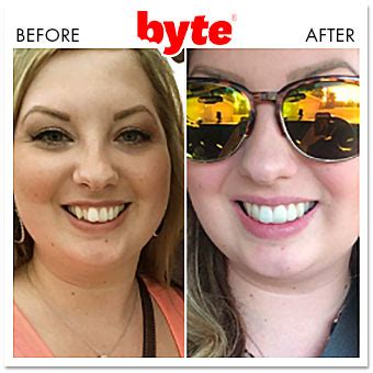 Byte Before & After Photos: Pics of Real Customer Results