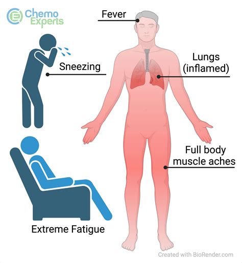 Flu-Like Symptoms - ChemoExperts