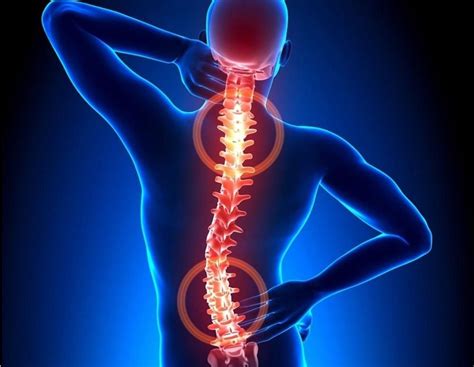 Physical Therapist's Guide to Degenerative Disk Disease