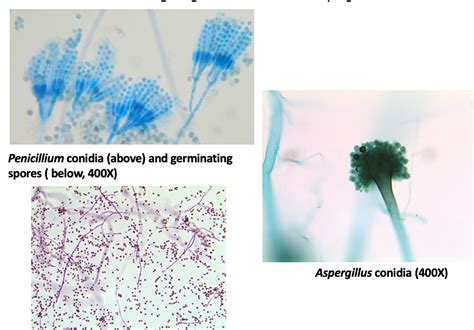 Solved 10-3 Examine and draw the slide of Penicillium | Chegg.com