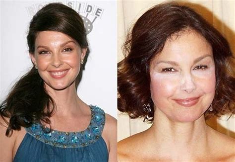 Ashley Judd before and after Plastic Surgery (8) | Celebrity plastic surgery online