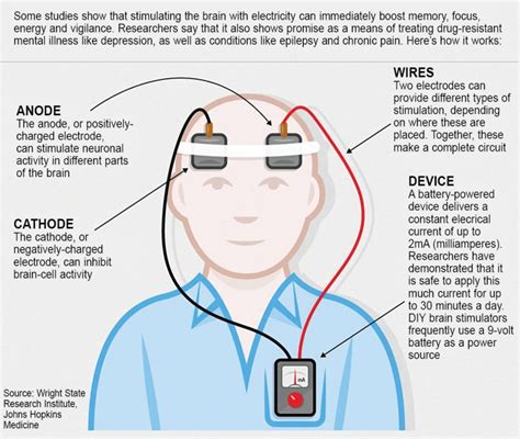 Electric Brain Stimulation Needs Caution | Healthcare