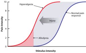 Allodynia - Physiopedia