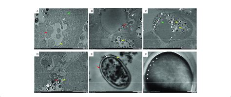 | TEM of the Microsporidia life cycle. (A) Early stages of ...