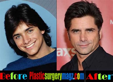 John Stamos Plastic Surgery Before and After | | Plastic Surgery Magazine