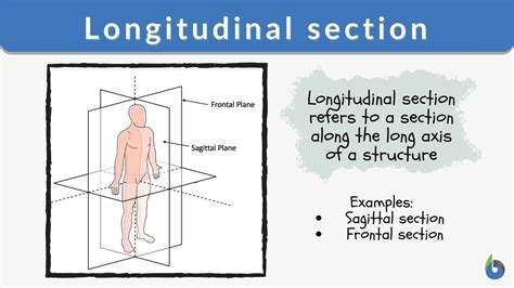 Longitudinal section - Definition and Examples - Biology Online Dictionary