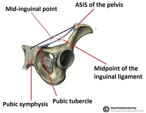 Mid ingunal point vs Midpoint of inguinal ligament... ( Note: Femoral artery begins at "mid ...