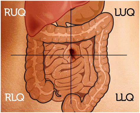 Acute and Chronic Left Upper Quadrant (LUQ) Abdominal Pain – Causes, Diagnosis, Treatment