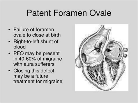 PPT - Migraine Prophylaxis in Patients with Patent Foramen Ovale ...