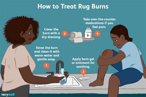 Rug Burns: Symptoms, Severity, Treatment