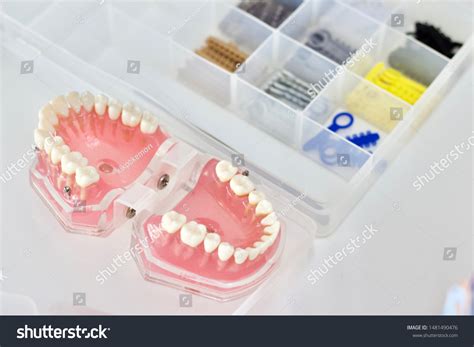 Oring Dental Orthodontics Elastomeric Rings Colourful Stock Photo ...