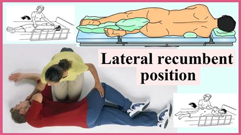 Left Lateral Decubitus Position