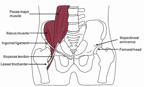 Psoas Syndrome - Overlooked Cause Of Back, Hip & Groin Pain