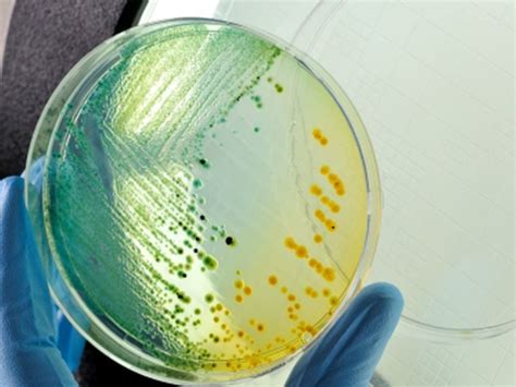 Some Multidrug-Resistant Bacterial Infections Down in U.S. - Consumer Health News | HealthDay