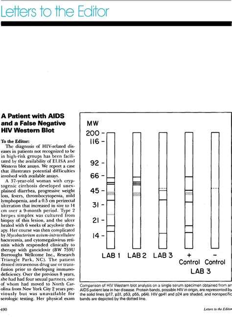 A Patient with AIDS and a False Negative HIV Western Blot | Infection ...