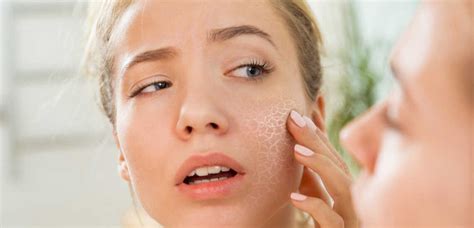 Understanding dry skin type - Dermatocare