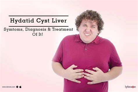 Hydatid Cyst Liver - Symtoms, Diagnosis & Treatment Of It! - By Dr. Manish K Gupta | Lybrate