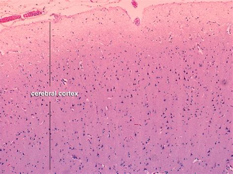 Chapter 1: Normal gross brain and microscopy | Renaissance School of ...