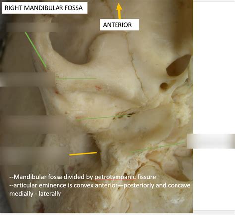 right mandibular fossa Diagram | Quizlet