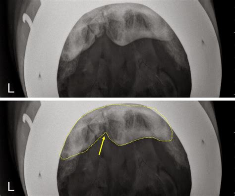 Michael Porter, Equine Veterinarian: Severe Navicular Disease in a Horse