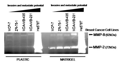 Representative zymogram of gelatin zymography analysis to detect the ...