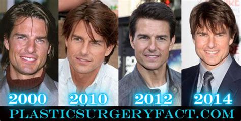 Tom Cruise Nose Job Before and After - Plastic Surgery Facts