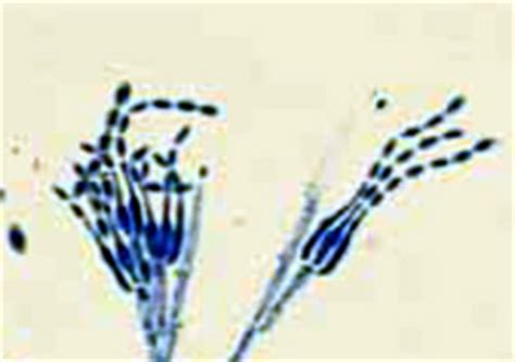 Neem Products - Paecilomyces Lilacinus