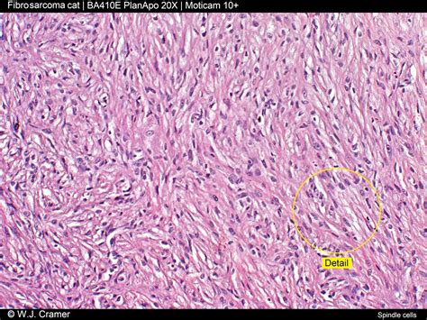 Motic Europe | Blog: Fibrosarcoma cat