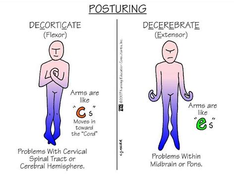 decorticate - definition - What is