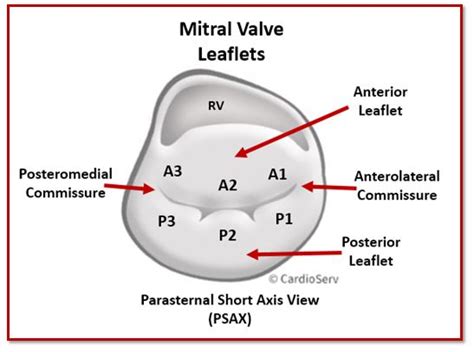 Mitral Valve Anatomy: Name 5 Components! Cardioserv