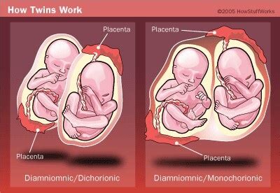 28 best images about Tree of Life (Placenta Info) on Pinterest | Milk ...