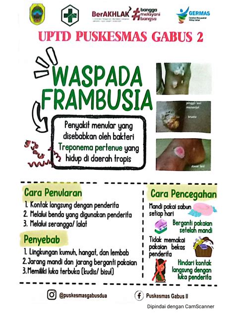 Poster Frambusia | PDF