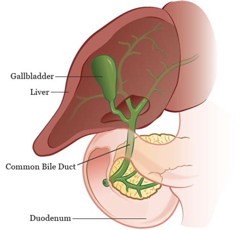 About Your Surgery to Treat Bile Duct Tumors | Memorial Sloan Kettering ...