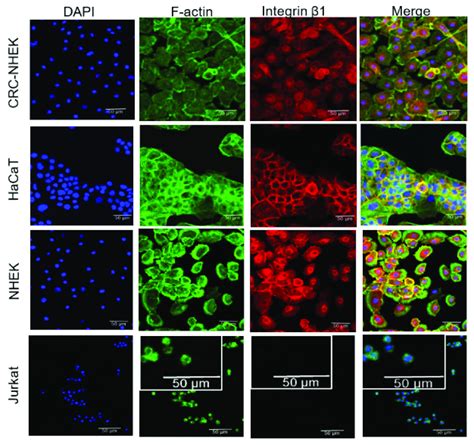 Human keratinocytes, CRC-HFK, HaCaT, and NHEK, but not Jurkat T cells ...