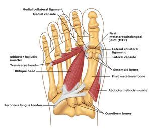 Metatarsalgia - Physiopedia