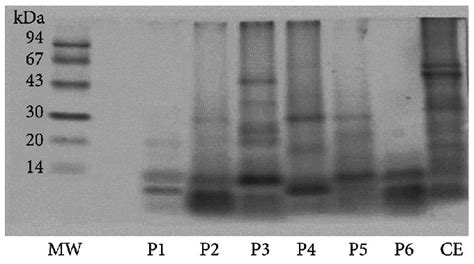 Tricine SDS-PAGE Electrophoresis. (MW) Molecular Weight Markers; (F1 to... | Download Scientific ...