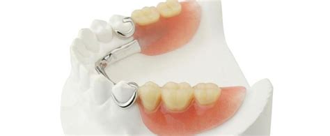 63 best Dental Flipper Online images on Pinterest | Dental, Dentistry and Teeth