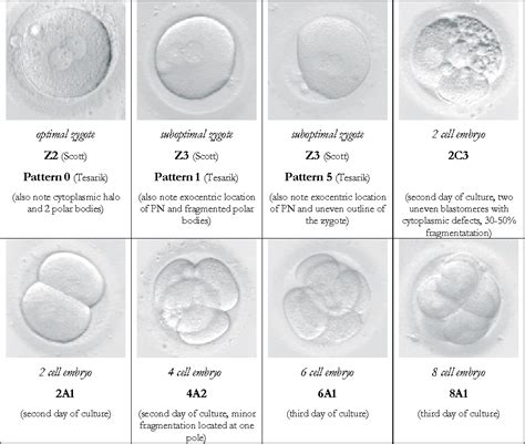 Ivf Embryo Quality And Day Embryo Grading After In Vitro | My XXX Hot Girl