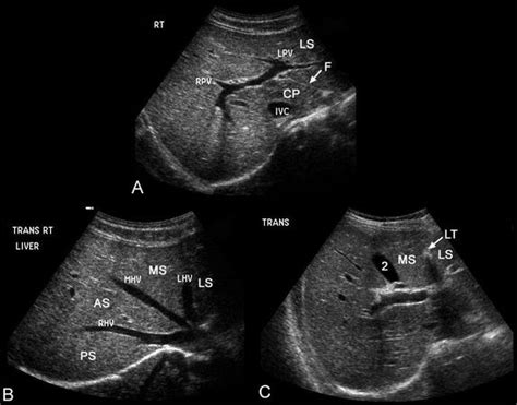 ultrasound [Nicks Radiology Wiki] | Medical ultrasound, Ultrasound, Ultrasound sonography